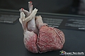 VBS_2857 - Cuore. Ipertrofia cardiaca - Mostra Body Worlds